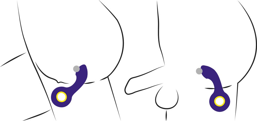 Vibrating G+P Spot Massager